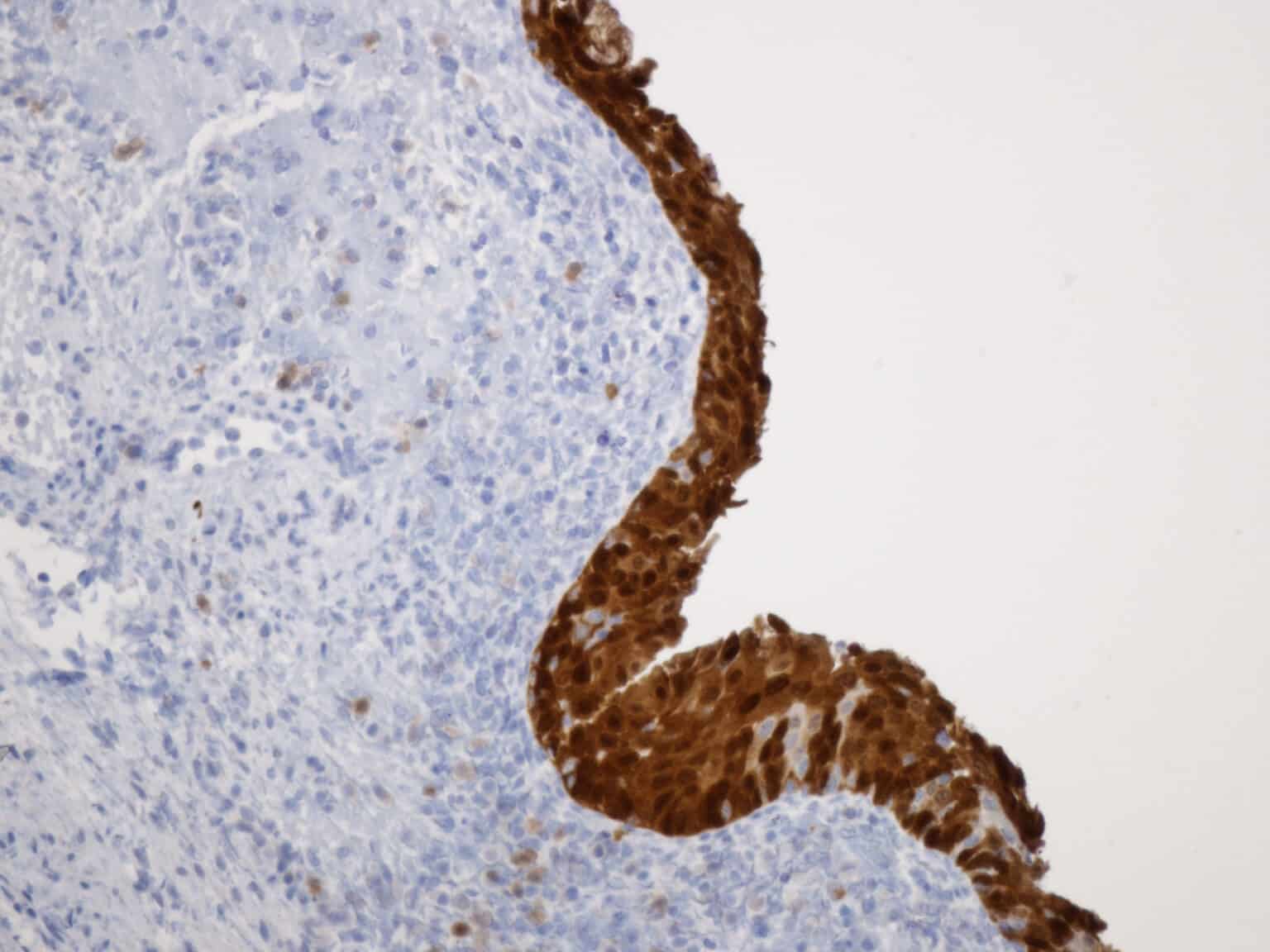 Immunohistochemical Stains - Pennsylvania Specialty Pathology
