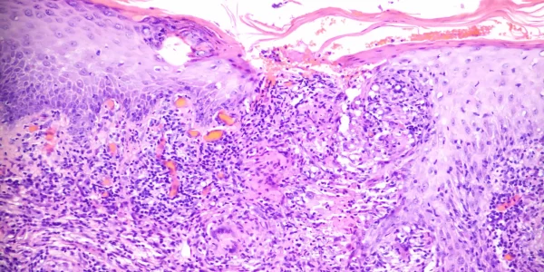 Spot Diagnosis from Launch Kits