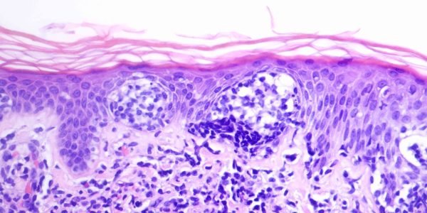 dermpath-pro-case-4621