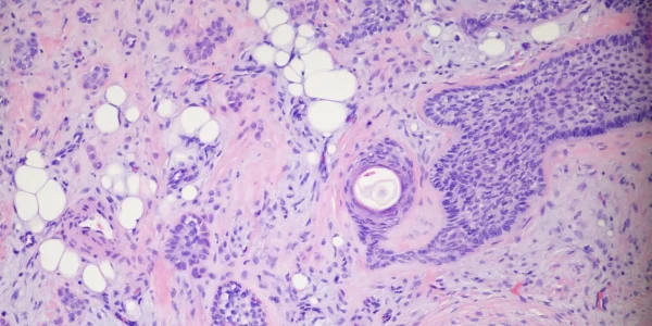 dermpath-pro-case-4632
