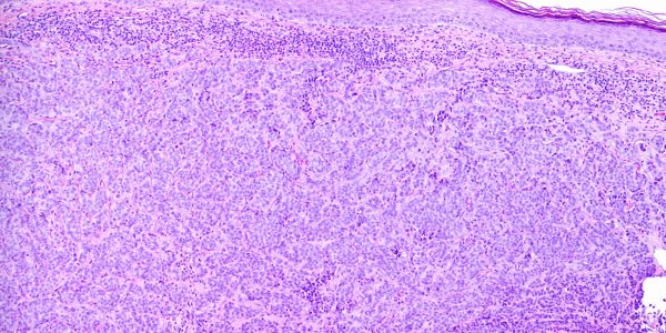pa-specialty-pathology-case-4619-000